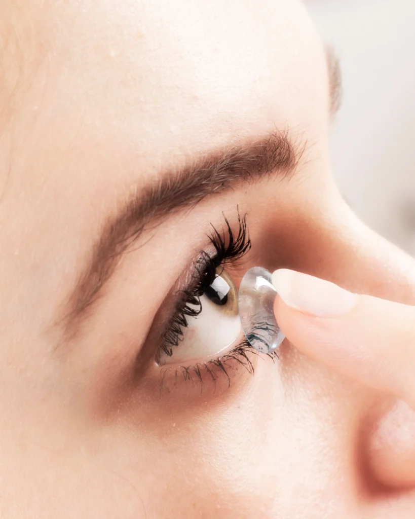 lentilles contact astigmates